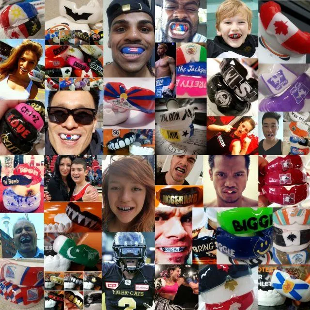 mouthguards