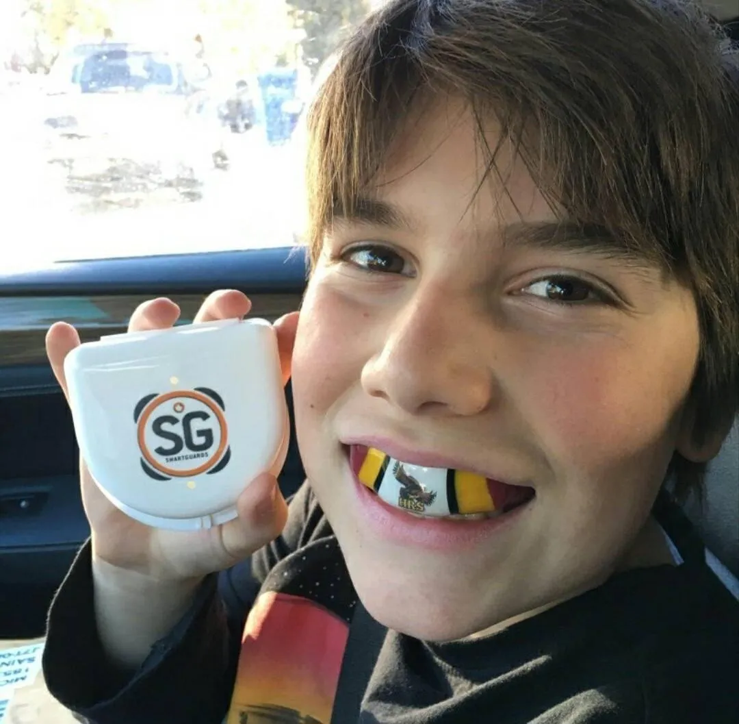 mouthguards