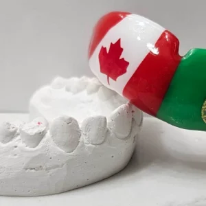 Custom Mouthguard